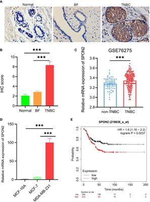 Knockdown of SPON2 inhibits the growth of triple-negative breast cancer